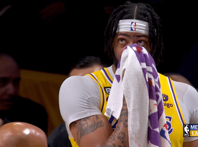 浓眉血染赛场：鼻梁被打破血流不止 詹姆斯确定缺席加索尔球衣退役仪式